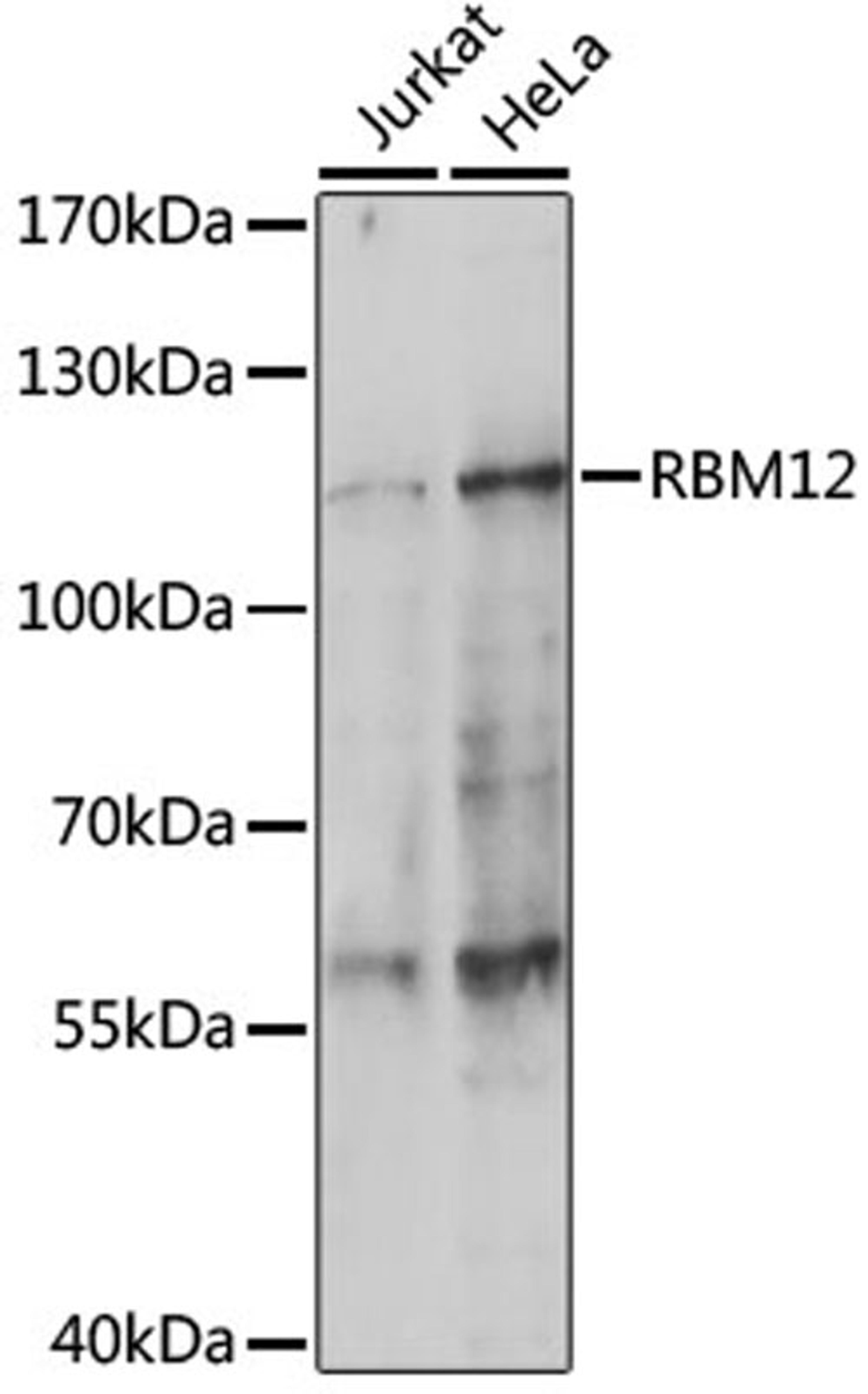 Western blot - RBM12 antibody (A14683)