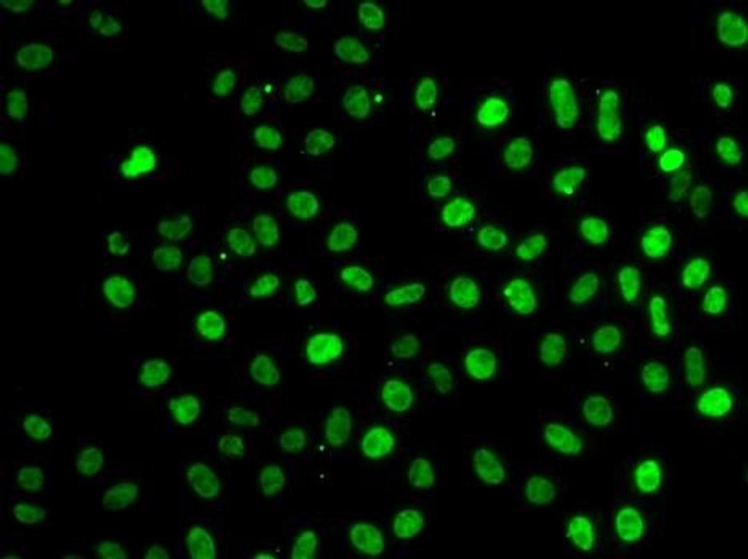 Immunofluorescense analysis of MCF7 cell using SF3B2 antibody