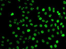 Immunofluorescense analysis of MCF7 cell using SF3B2 antibody