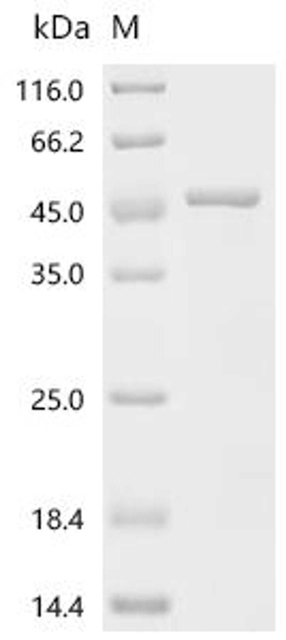 (Tris-Glycine gel) Discontinuous SDS-PAGE (reduced) with 5% enrichment gel and 15% separation gel.