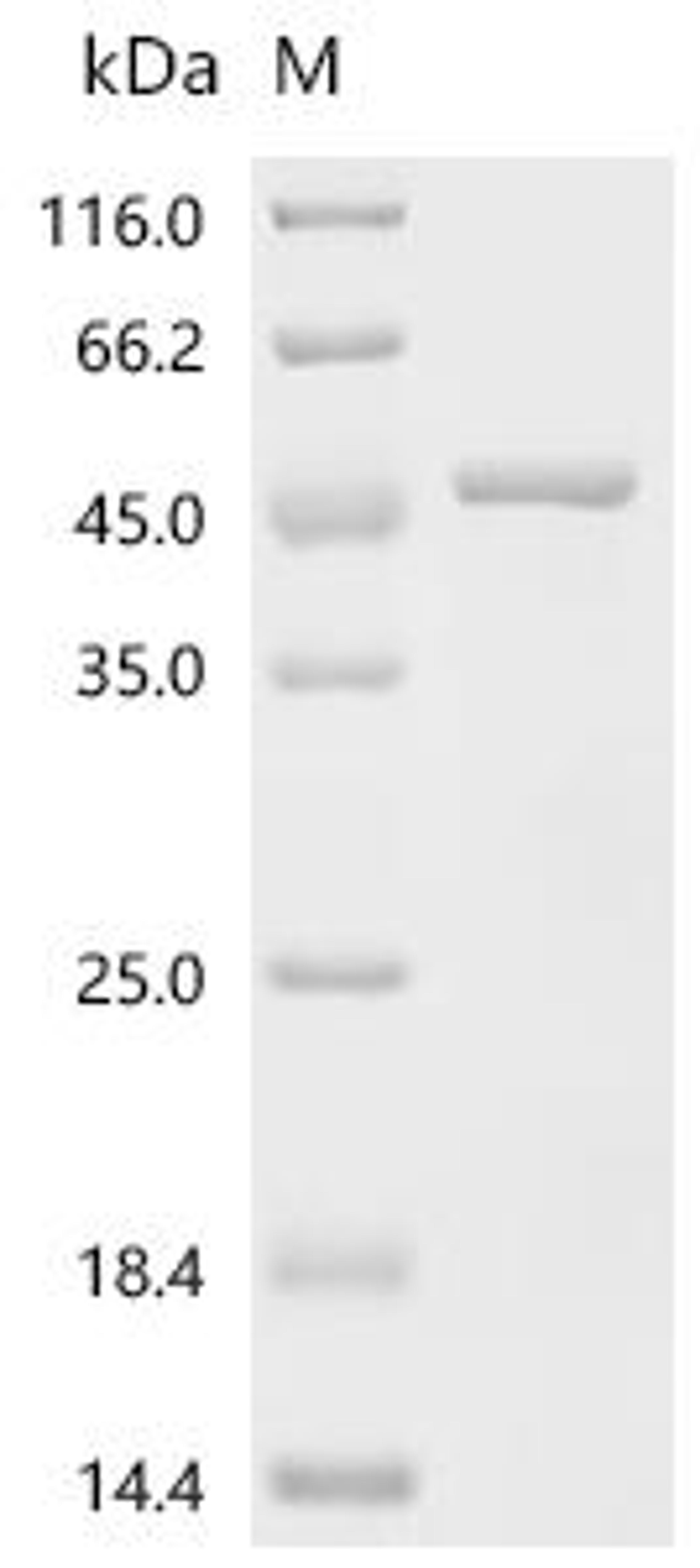 (Tris-Glycine gel) Discontinuous SDS-PAGE (reduced) with 5% enrichment gel and 15% separation gel.