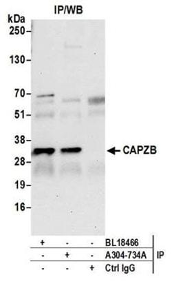 Detection of human CAPZB by western blot of immunoprecipitates.