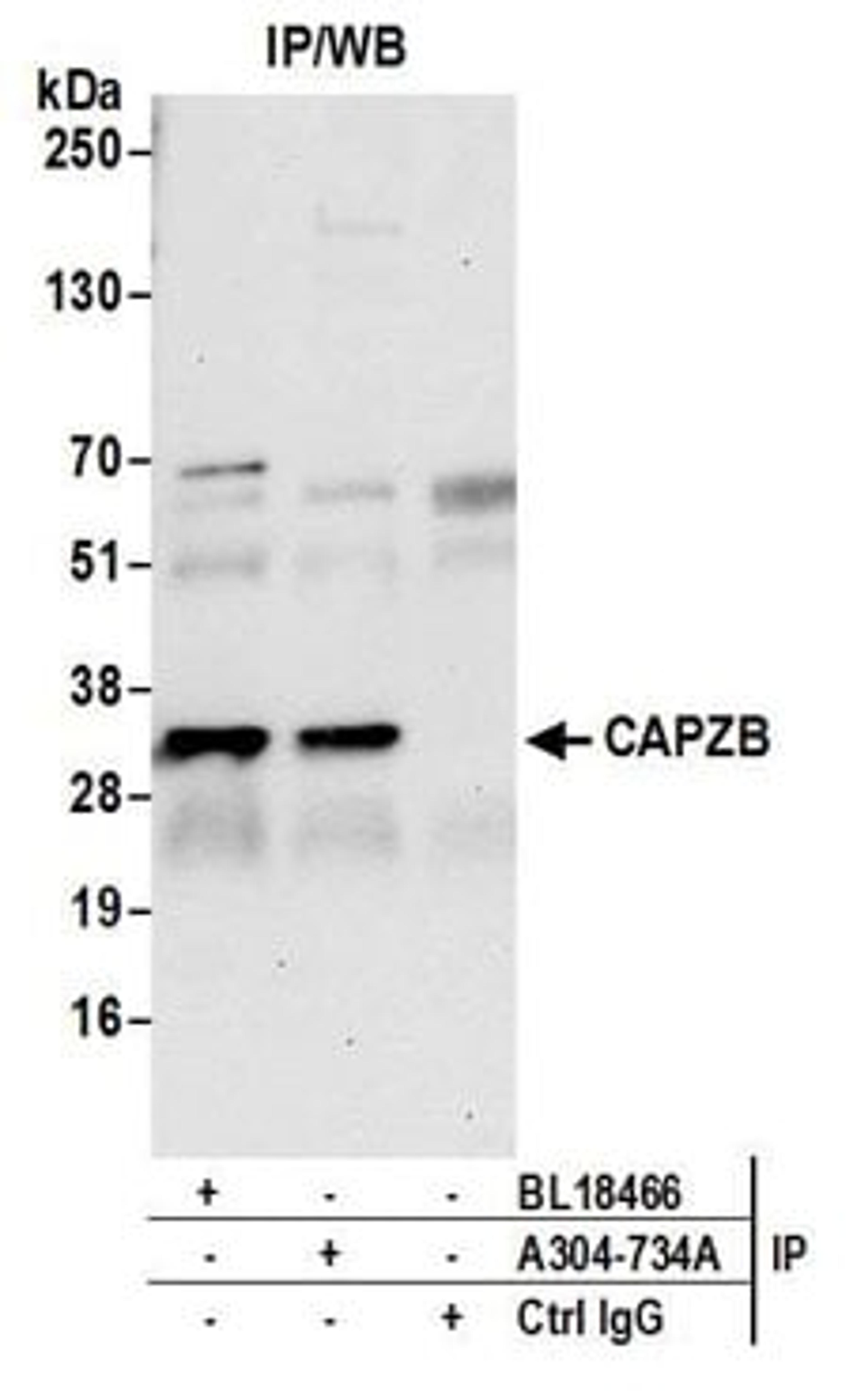 Detection of human CAPZB by western blot of immunoprecipitates.