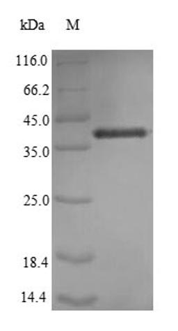 (Tris-Glycine gel) Discontinuous SDS-PAGE (reduced) with 5% enrichment gel and 15% separation gel.