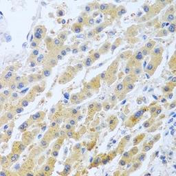 Immunohistochemical staining of rat kidney tissue using STC1 antibody (dilution of 1:100)