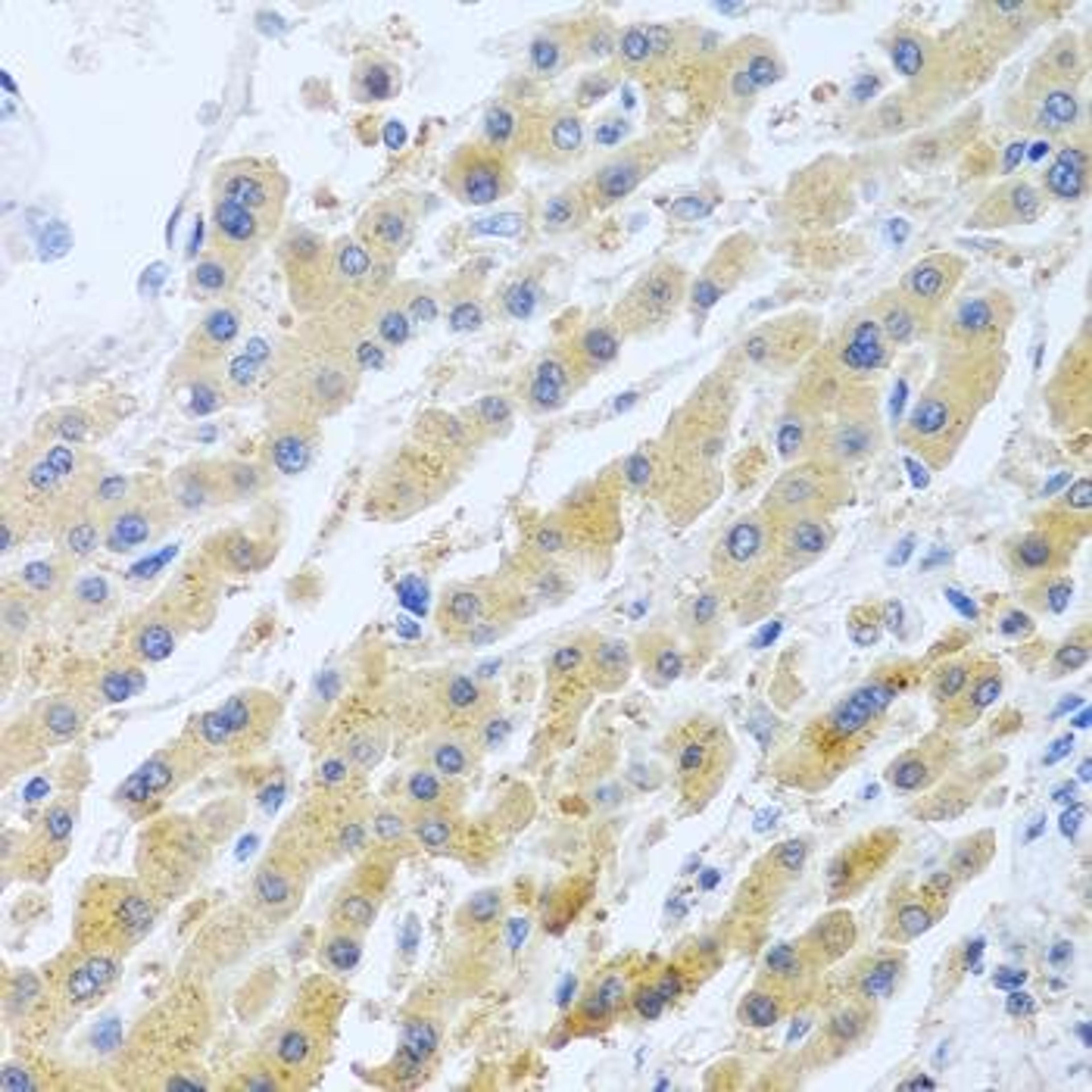 Immunohistochemical staining of rat kidney tissue using STC1 antibody (dilution of 1:100)