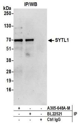 Detection of human SYTL1 by WB of IP.