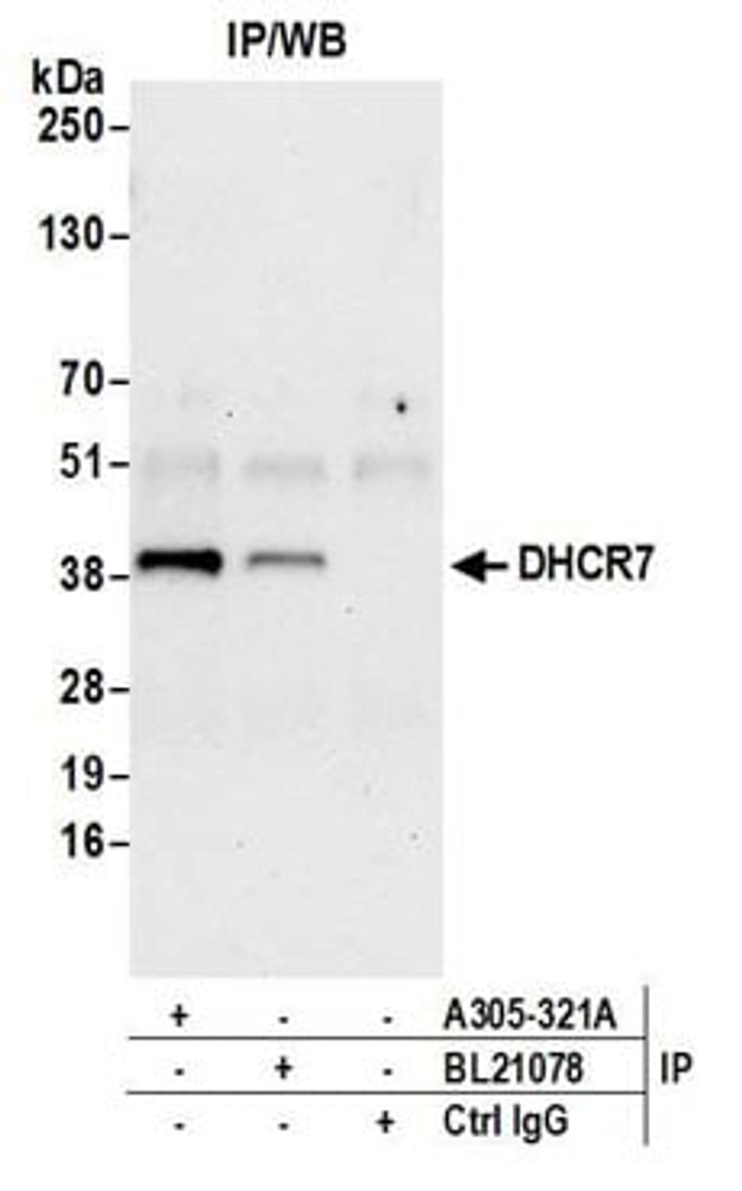 Detection of human DHCR7 by western blot of immunoprecipitates.