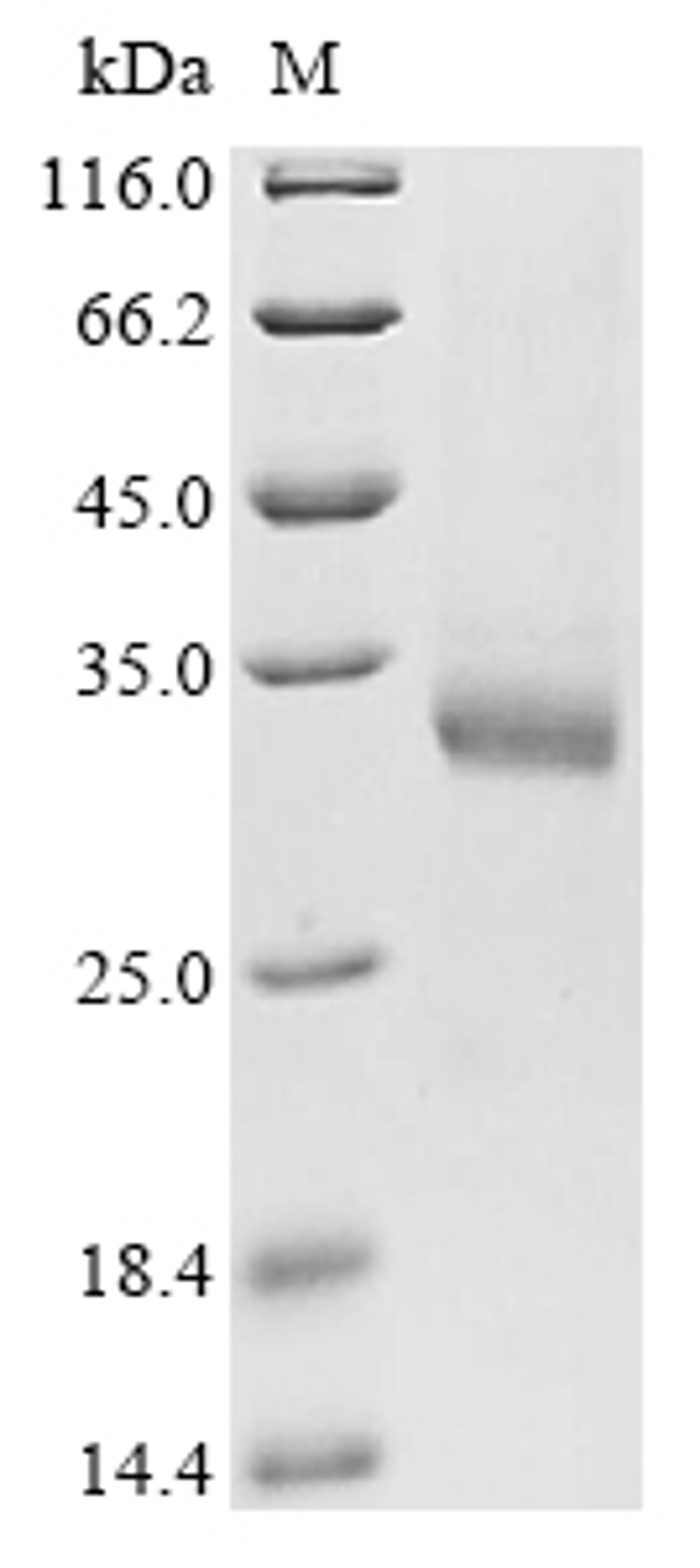 (Tris-Glycine gel) Discontinuous SDS-PAGE (reduced) with 5% enrichment gel and 15% separation gel.