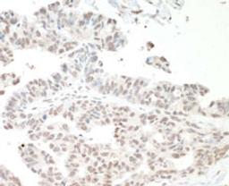 Detection of human NF110 by immunohistochemistry.