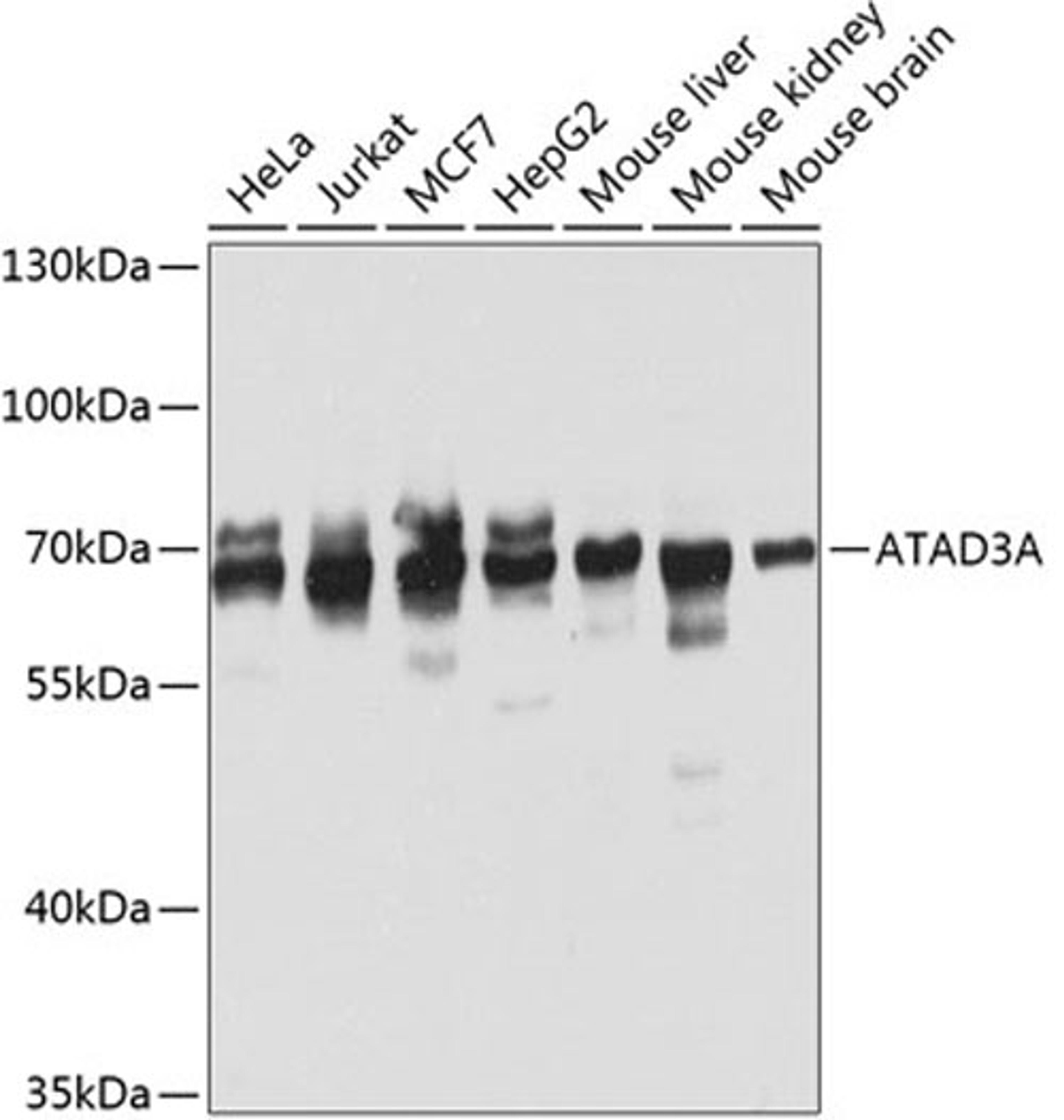 Western blot - ATAD3A antibody (A8230)