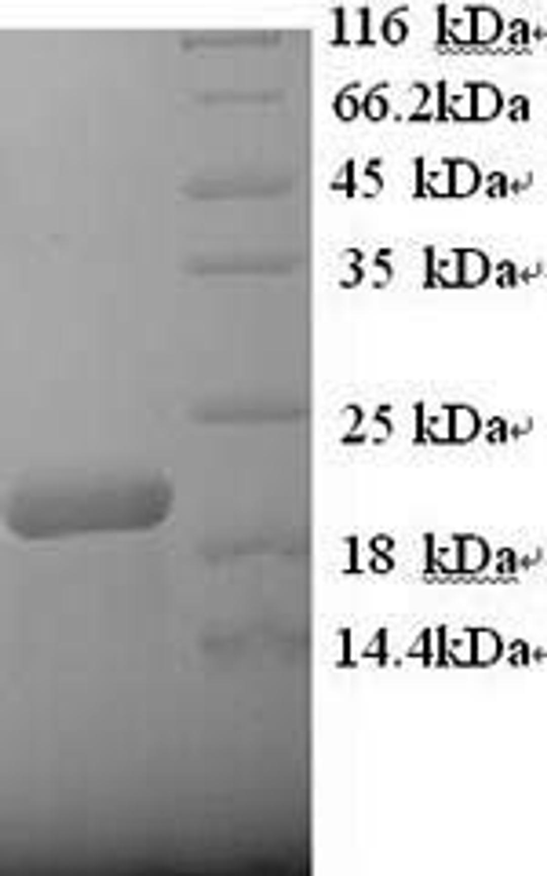 (Tris-Glycine gel) Discontinuous SDS-PAGE (reduced) with 5% enrichment gel and 15% separation gel.