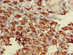 Immunohistochemistry of paraffin-embedded human adrenal gland tissue using CSB-PA002524LA01HU at dilution of 1:100