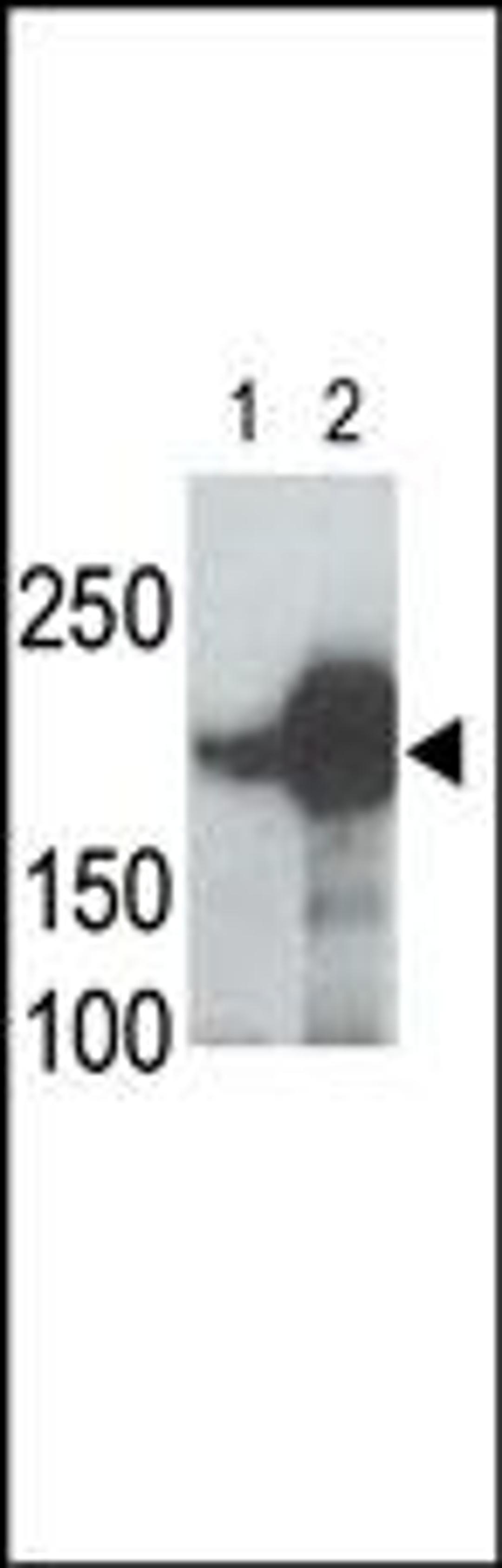 LRP5 Antibody is used in Western blot to detect recombinant human LRP5 (Lane 1) and mouse LRP5 (Lane 2) proteins in transfected 293 cell lysates. Data is kindly provided by Drs. V. Harris and S. Aaronson from the Mount Sinai School of Medicine (New York, 