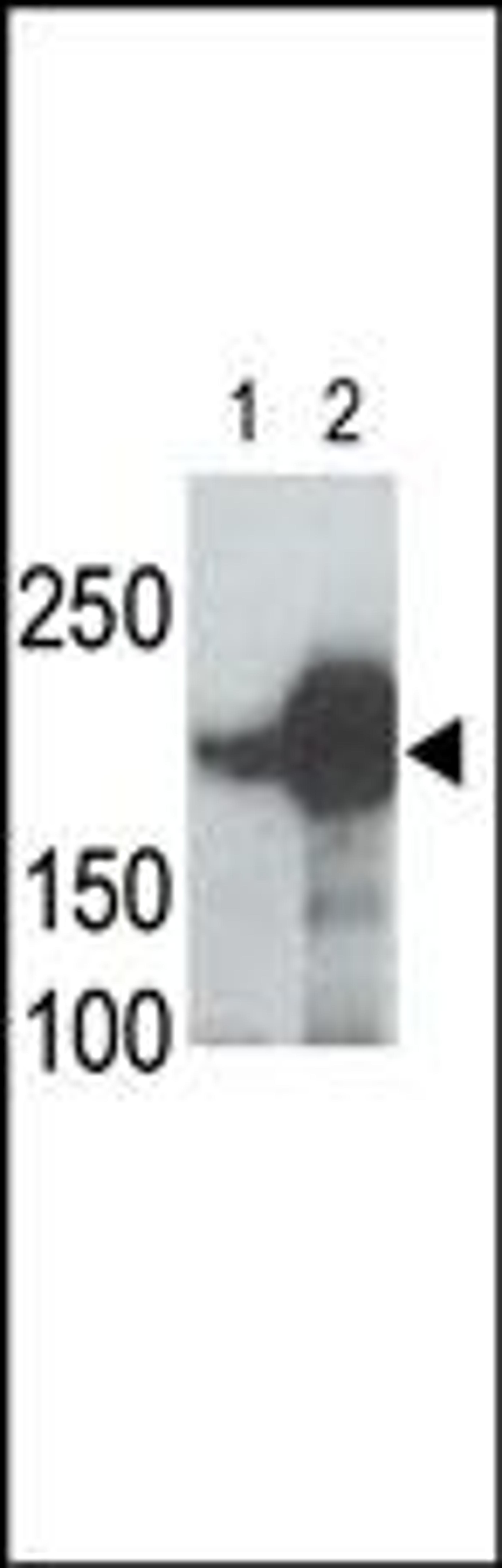 LRP5 Antibody is used in Western blot to detect recombinant human LRP5 (Lane 1) and mouse LRP5 (Lane 2) proteins in transfected 293 cell lysates. Data is kindly provided by Drs. V. Harris and S. Aaronson from the Mount Sinai School of Medicine (New York, 