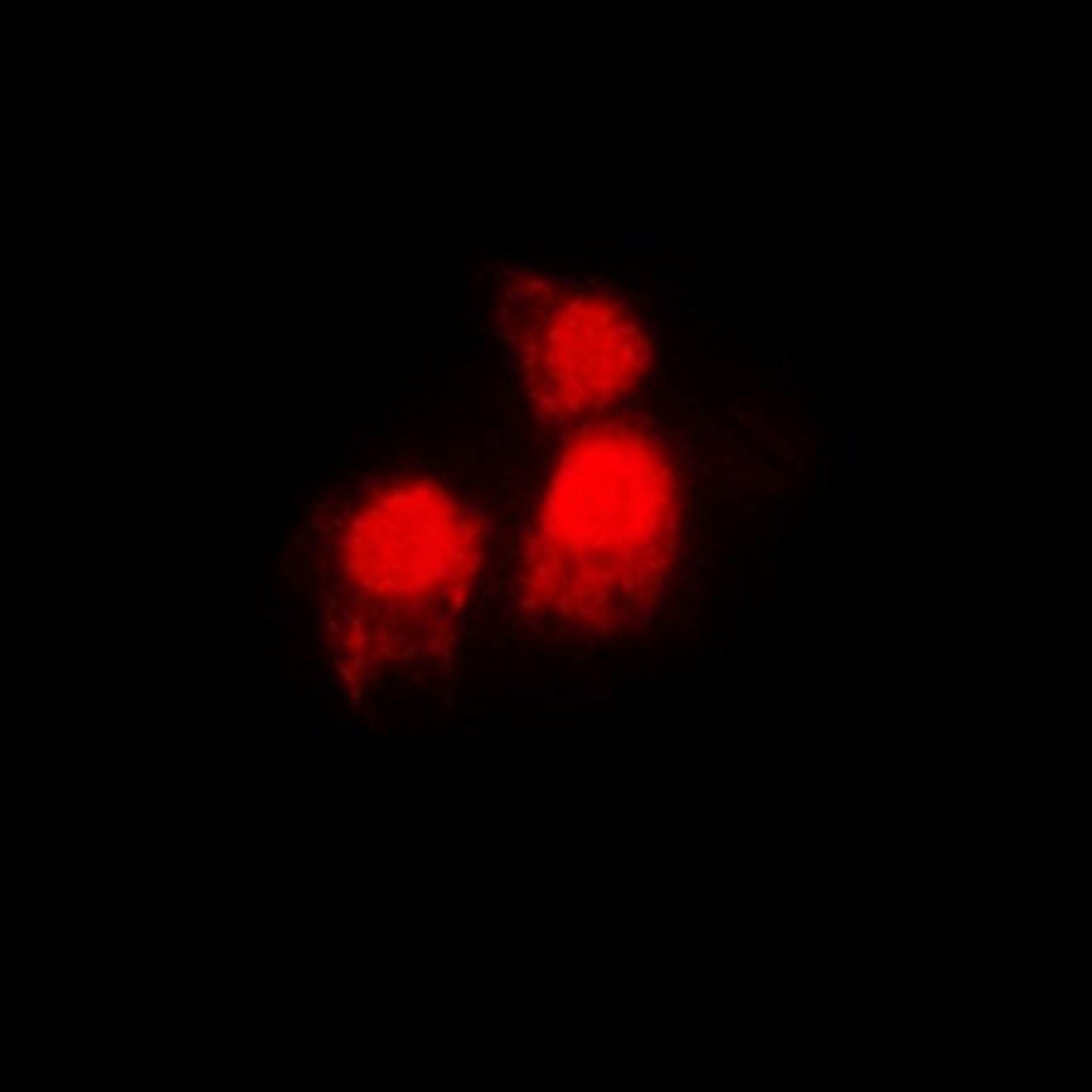 Immunofluorescense analysis of MCF7 cells using SIAH2 antibody