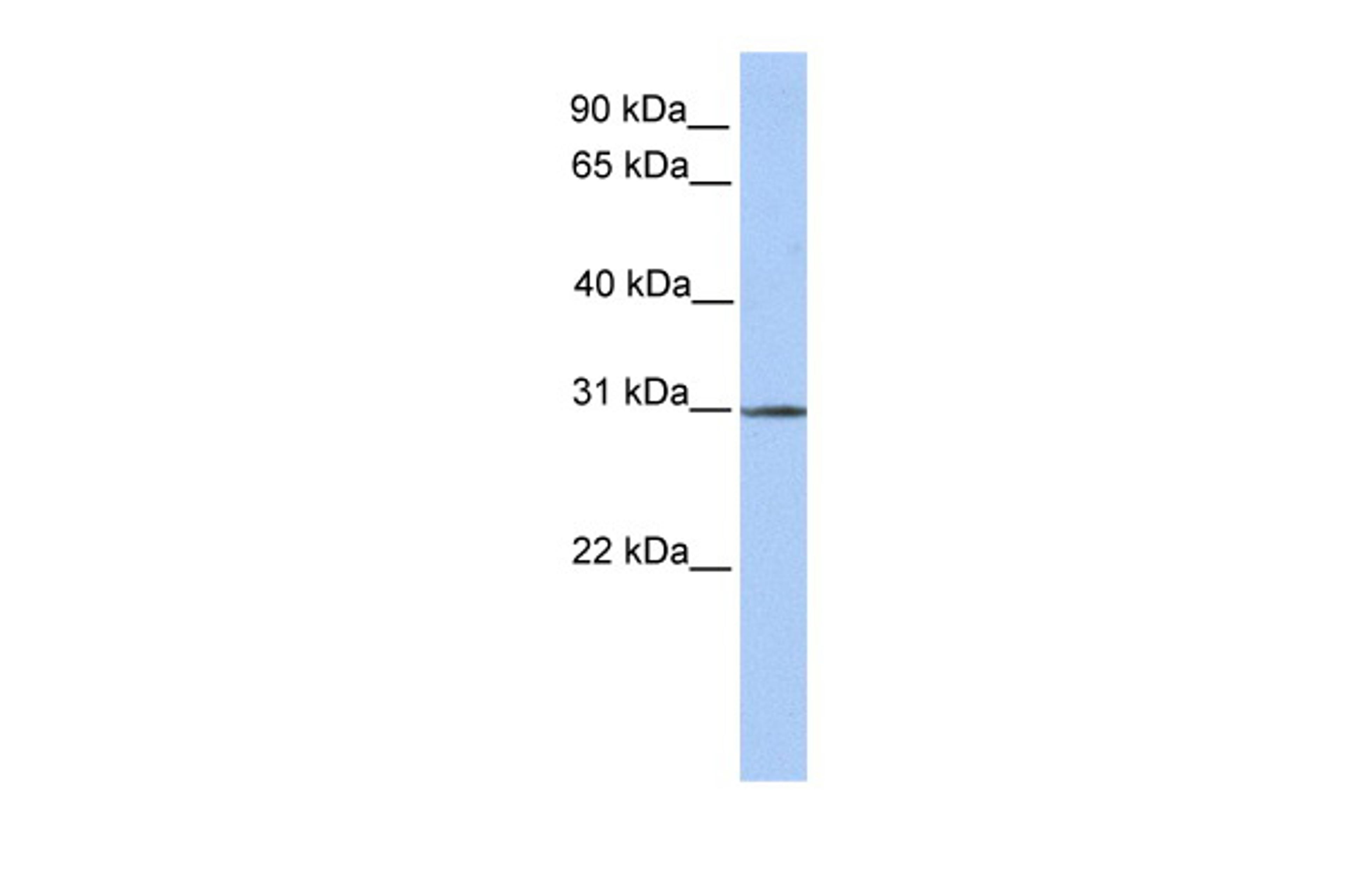 Antibody used in WB on Human Lung at 0.2-1 ug/ml.