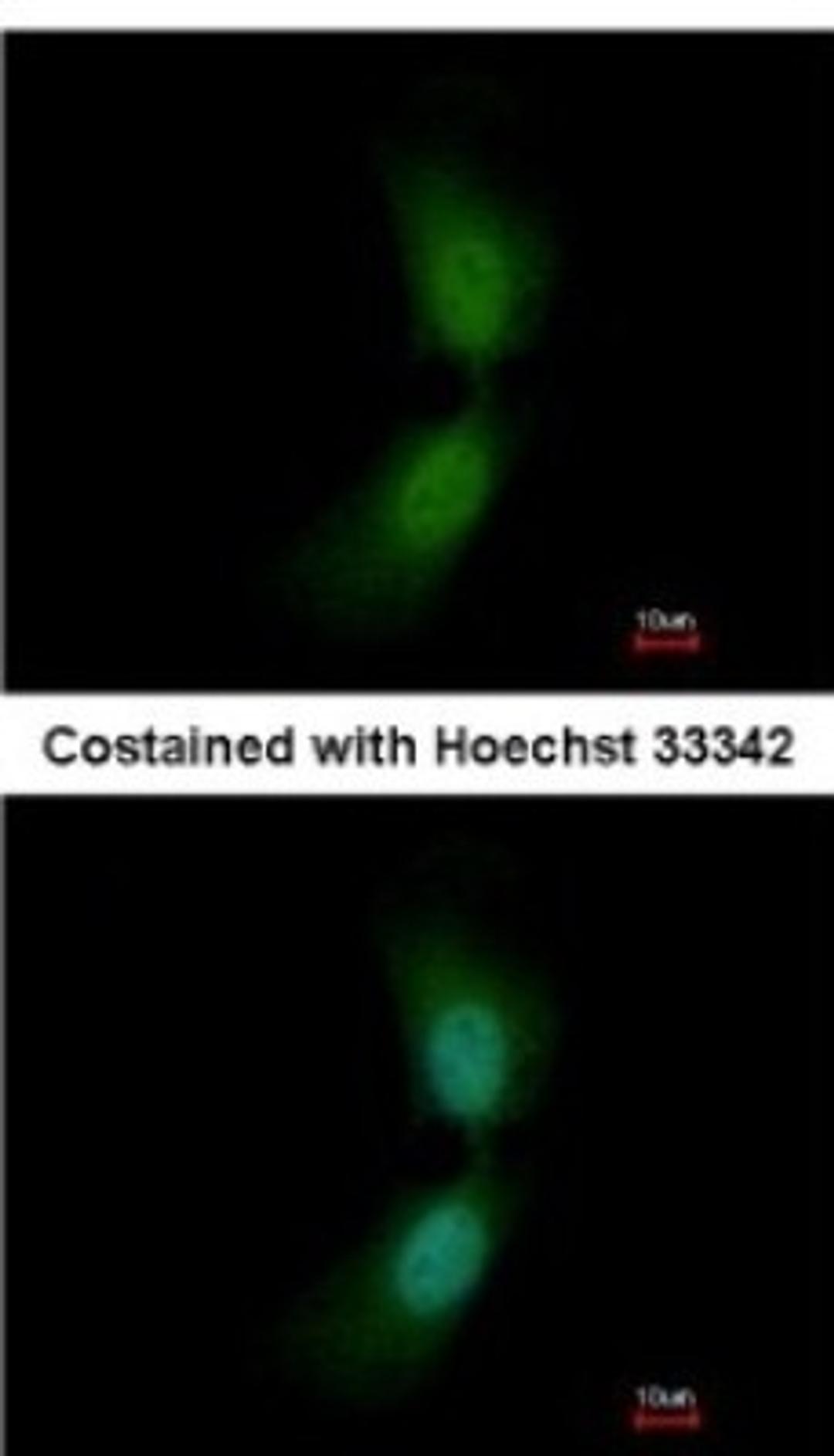 Immunocytochemistry/Immunofluorescence: Suppressor of Fused Antibody [NBP2-20536] - Analysis of paraformaldehyde-fixed HeLa, using antibody at 1:200 dilution.