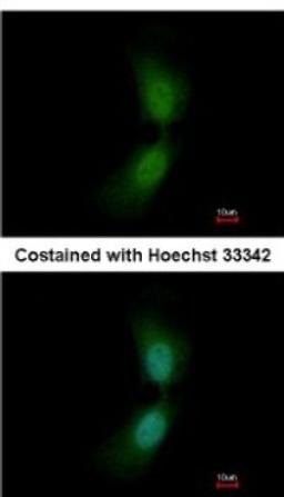 Immunocytochemistry/Immunofluorescence: Suppressor of Fused Antibody [NBP2-20536] - Analysis of paraformaldehyde-fixed HeLa, using antibody at 1:200 dilution.