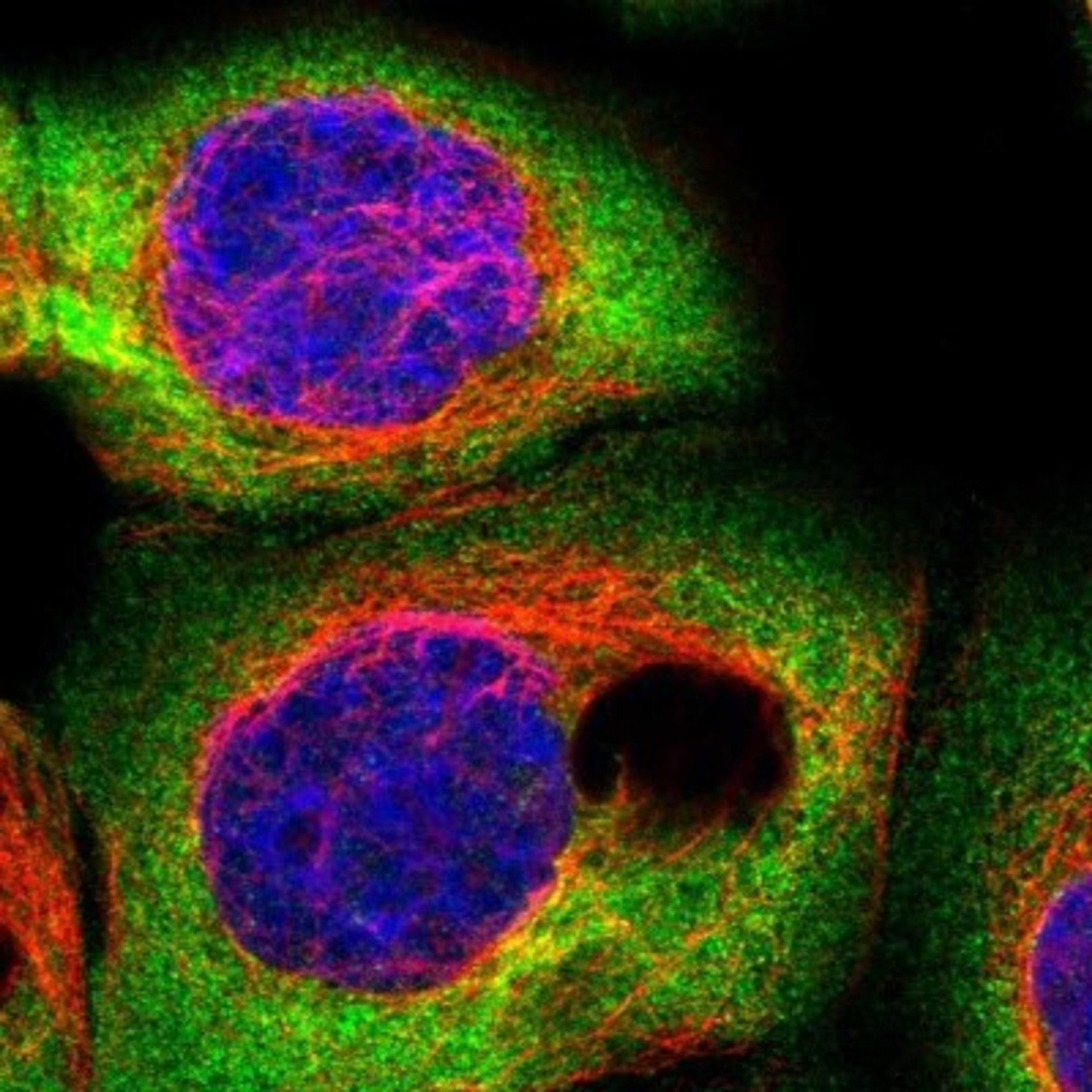 Immunocytochemistry/Immunofluorescence: CSDE1 Antibody [NBP1-85341] - Staining of human cell line A-431 shows positivity in cytoplasm.