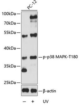 Western blot - Phospho-p38 MAPK-T180 antibody (AP0056)