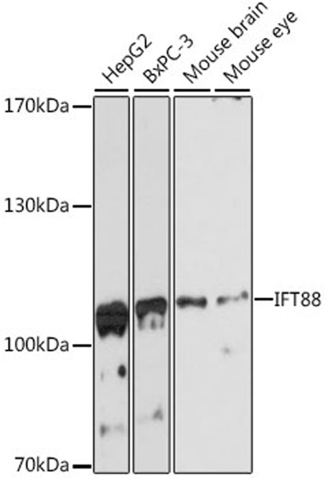 Western blot - IFT88 antibody (A13054)