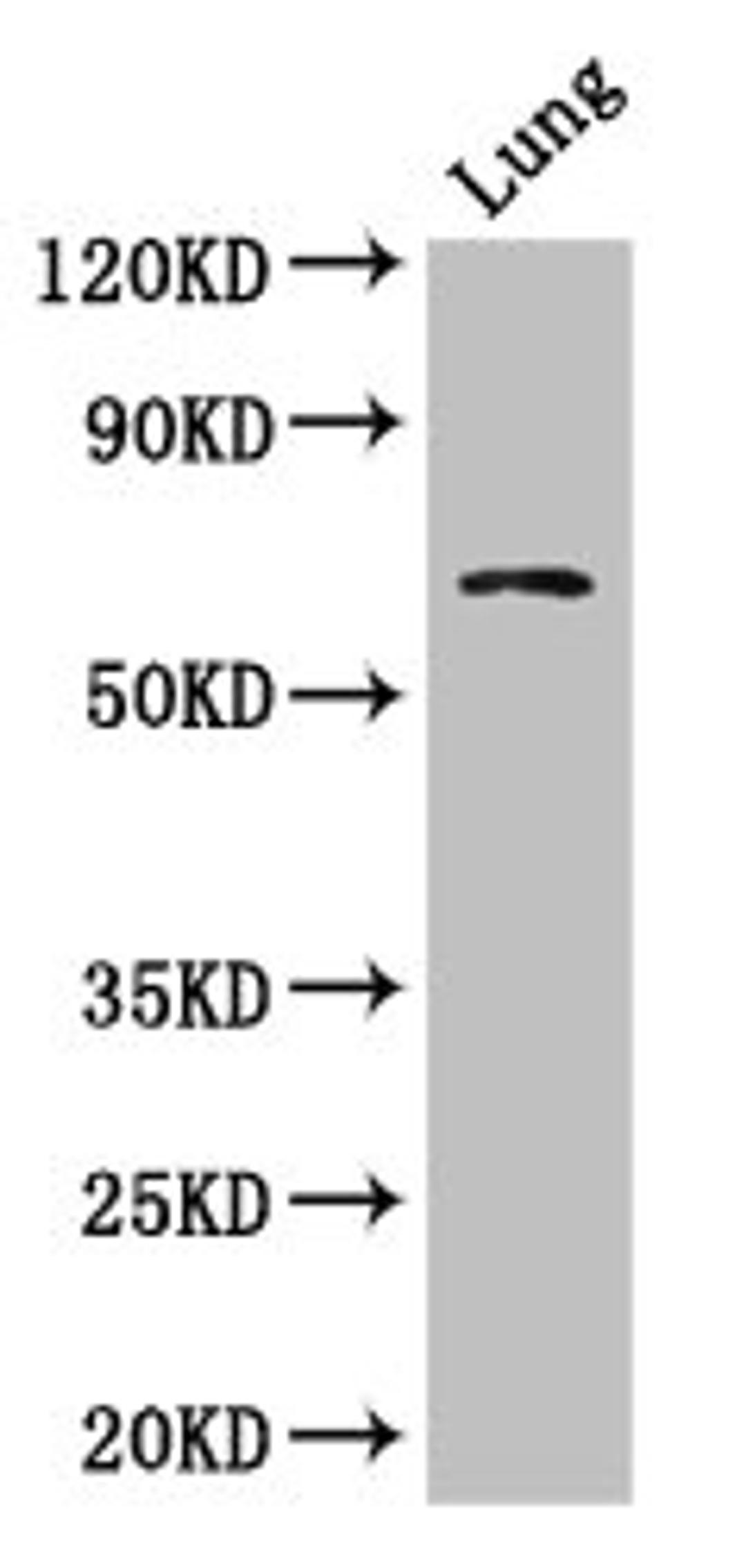 Western Blot. Positive WB detected in: Mouse lung tissue. All lanes: BBS1 antibody at 1ug/ml. Secondary. Goat polyclonal to rabbit IgG at 1/50000 dilution. Predicted band size: 66, 70, 50 kDa. Observed band size: 66 kDa.