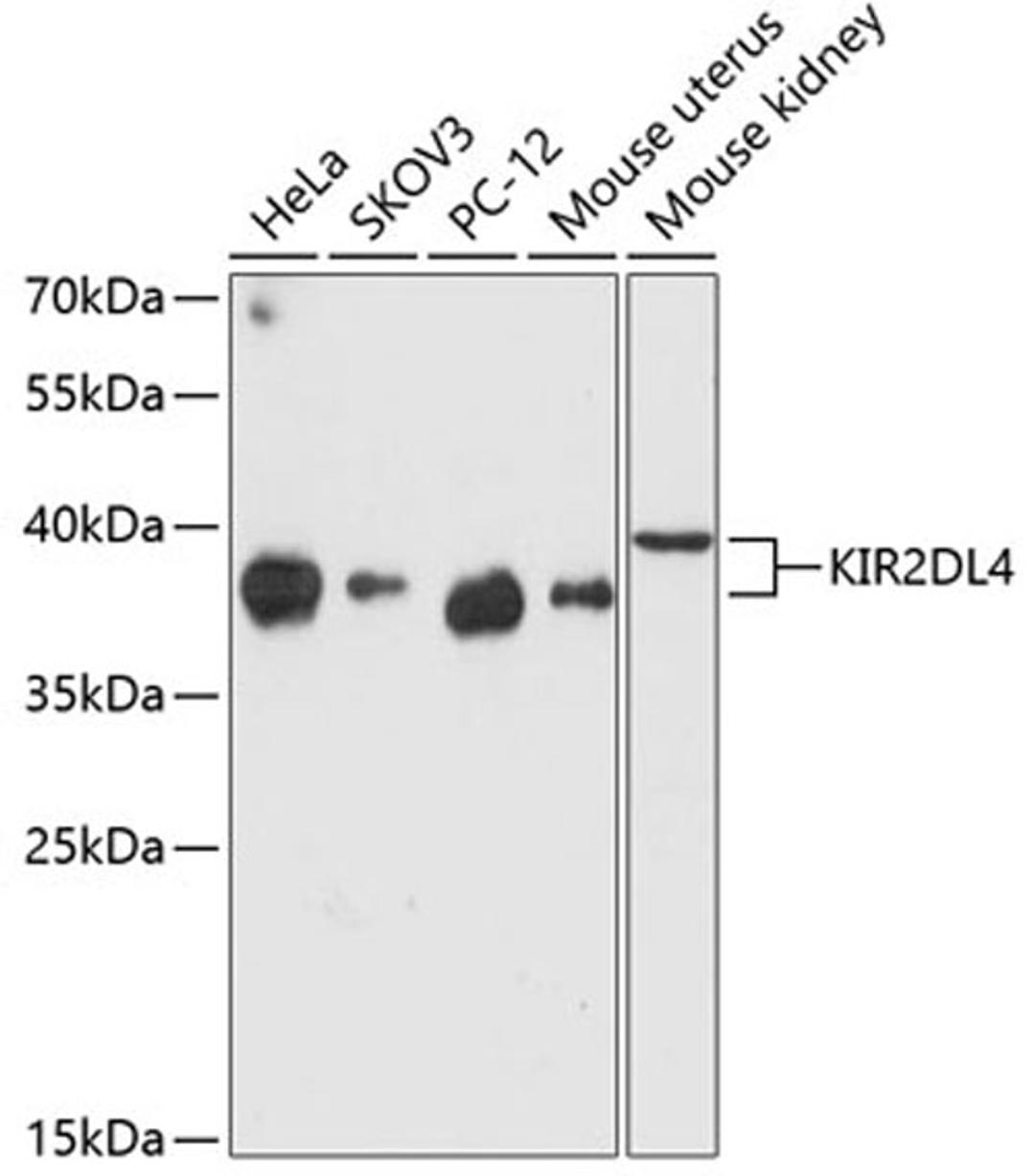 Western blot - KIR2DL4 antibody (A12836)