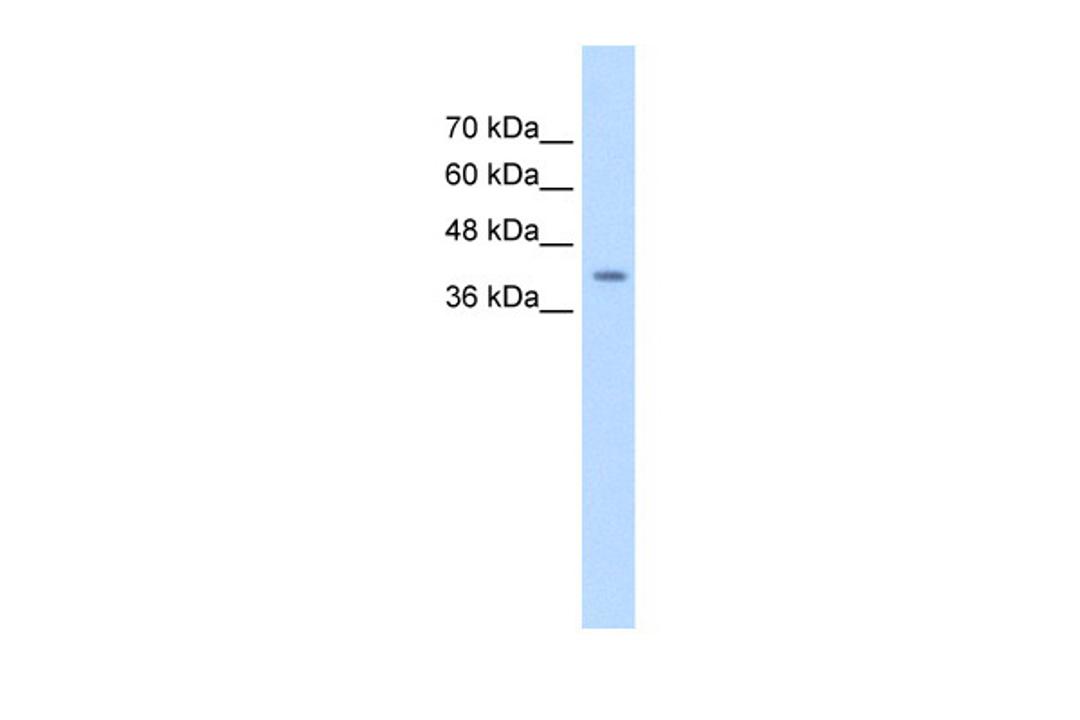 Antibody used in WB on Human HepG2 at 0.625 ug/ml.