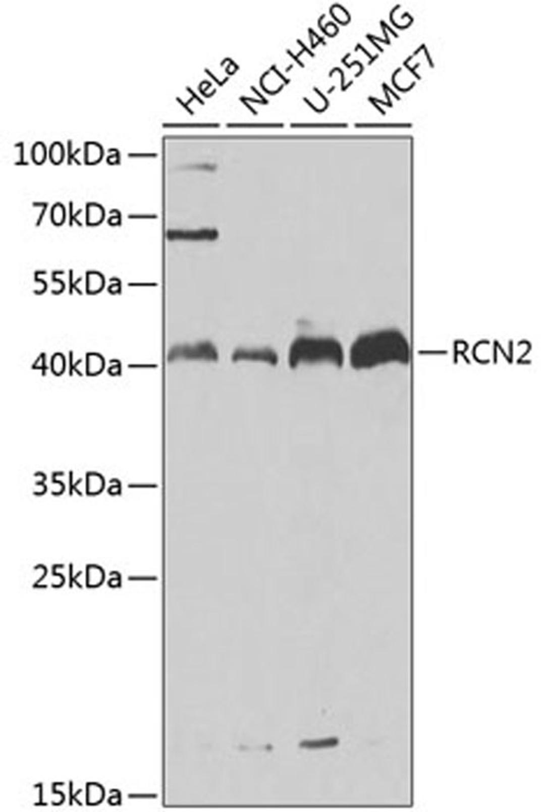 Western blot - RCN2 antibody (A7721)