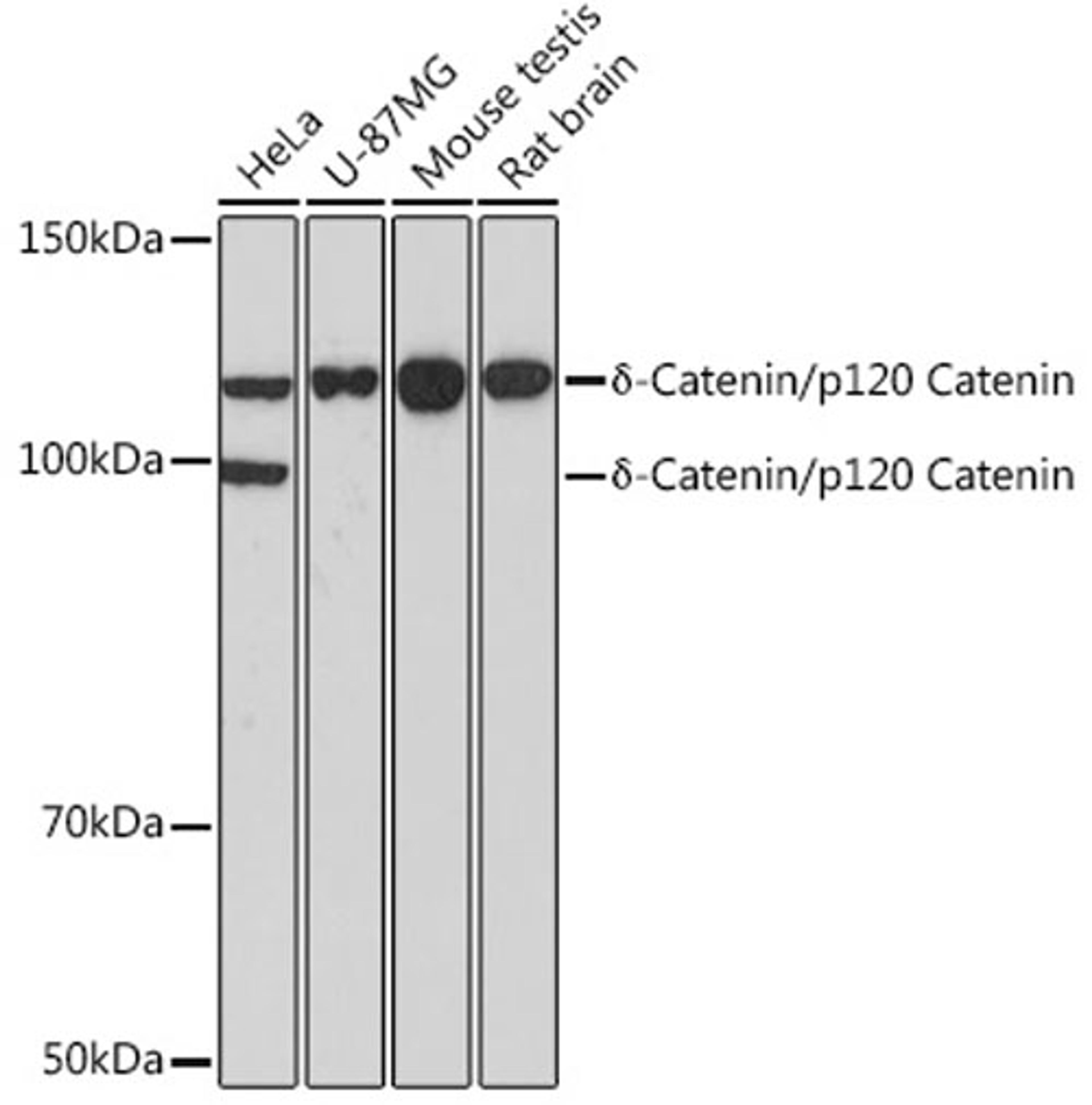 Western blot - d-Catenin/p120 Catenin Rabbit mAb (A11399)