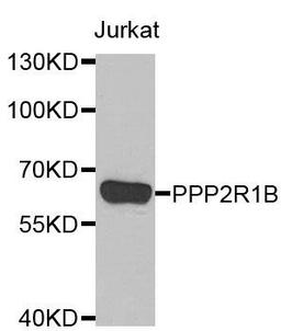 Western blot analysis of extracts of Jurkat cell line using PPP2R1B antibody