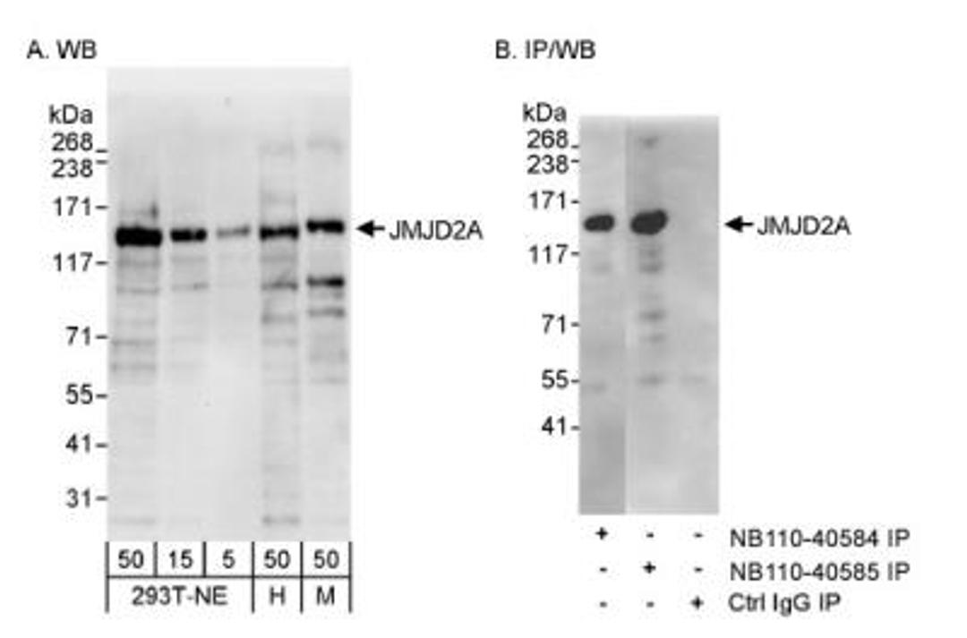 Western Blot: Lysine (K)-specific Demethylase 4A/KDM4A/JMJD2A Antibody [NB110-40585] - Detection of Human and Mouse Lysine (K)-specific Demethylase 4A/KDM4A/JMJD2A  on HeLa whole cell lysate using NB110-40585. Lysine (K)-specific Demethylase 4A/KDM4A/JMJD2A  was also immunoprecipitated by rabbit anti-Lysine (K)-specific Demethylase 4A/KDM4A/JMJD2A  antibody NB110-40584.