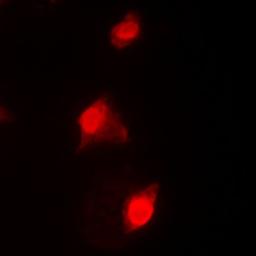 Immunofluorescense analysis of HeLa cells using RAD51C antibody