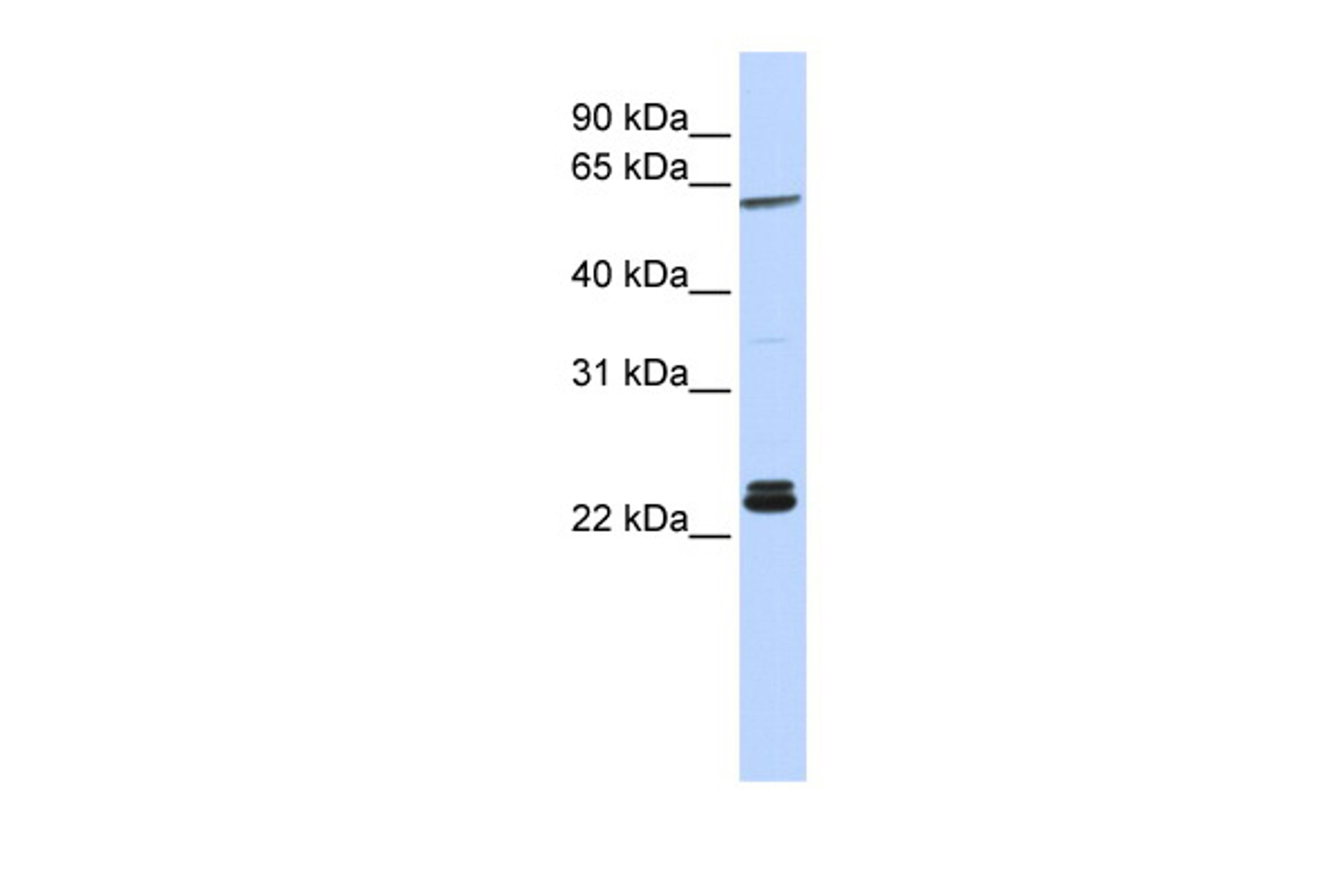 Antibody used in WB on Human HeLa at 0.2-1 ug/ml.