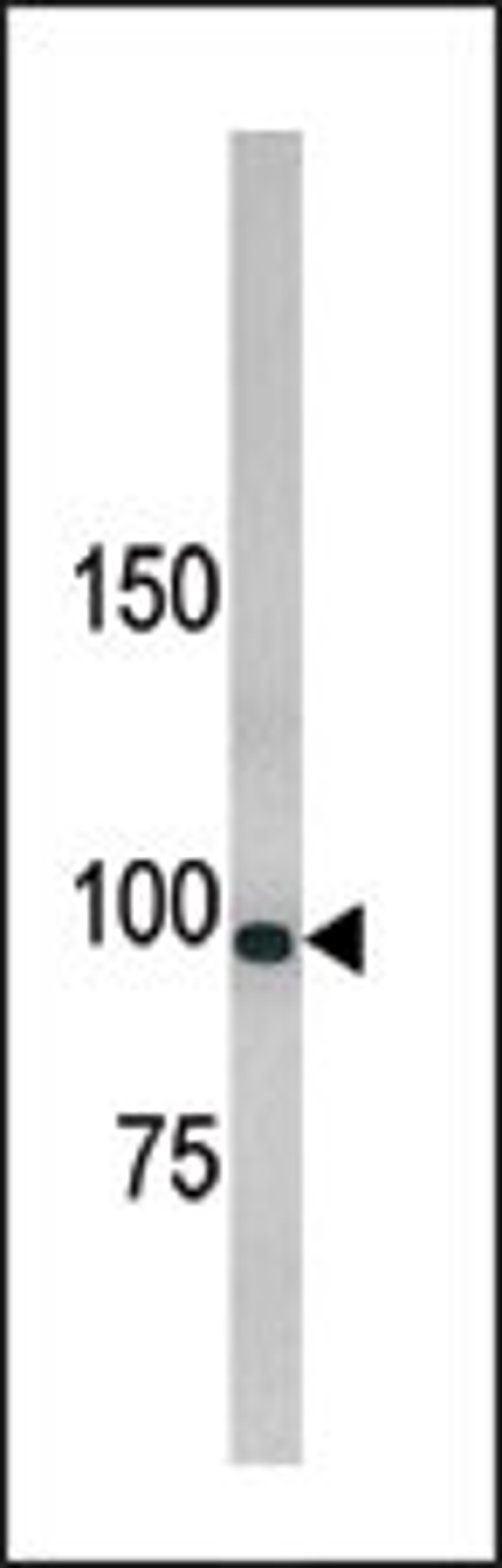 Western blot analysis of anti-hLLGL1 Pab in 293 cell line lysate.