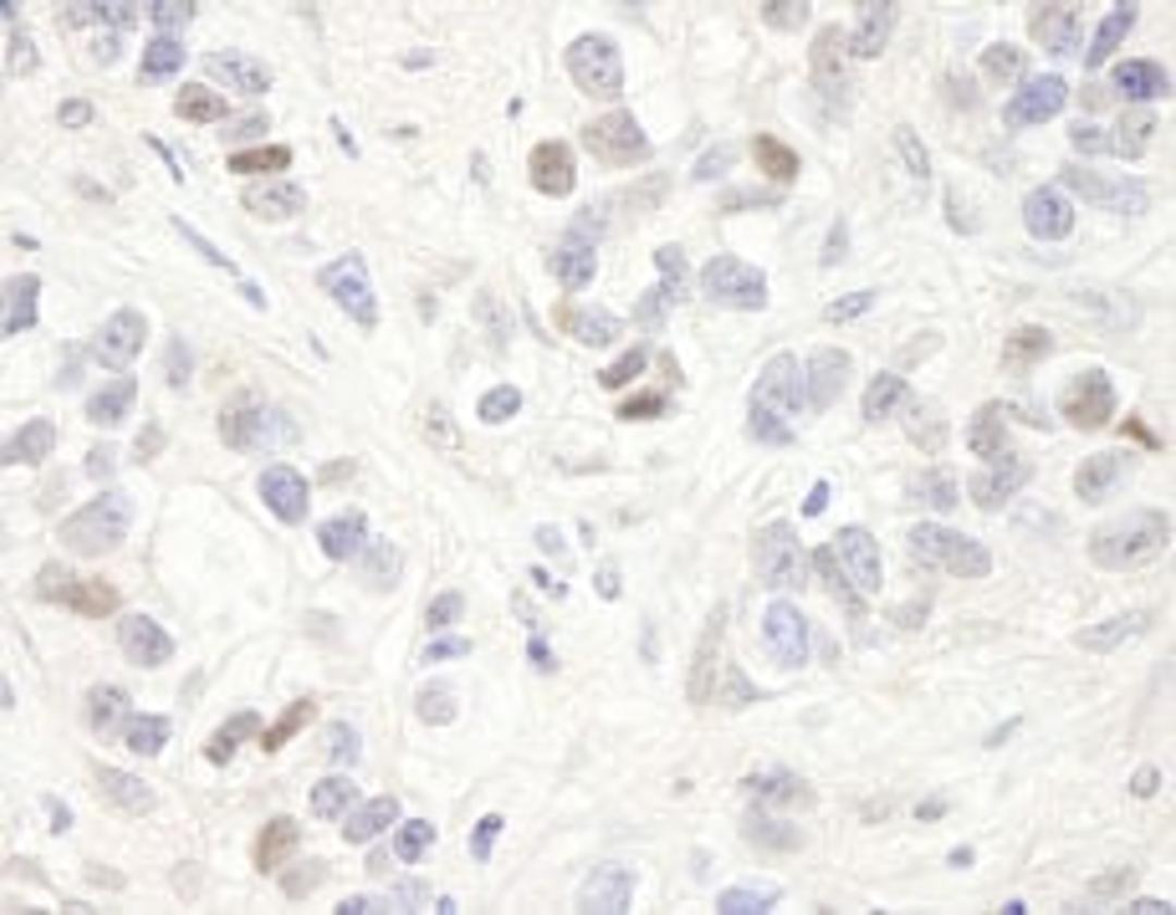 Detection of human MAGED2 by immunohistochemistry.