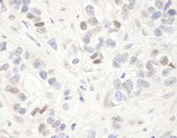 Detection of human MAGED2 by immunohistochemistry.