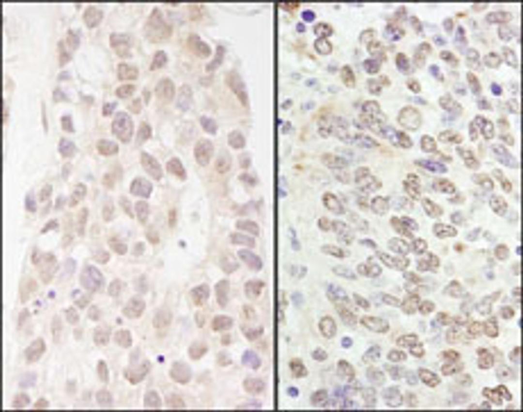 Detection of human and mouse p66beta/GATAD2B by immunohistochemistry.