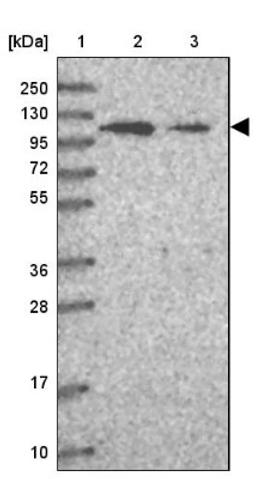 Western Blot: UTP14C Antibody [NBP2-33483] - Lane 1: Marker [kDa] 250, 130, 95, 72, 55, 36, 28, 17, 10<br/>Lane 2: Human cell line RT-4<br/>Lane 3: Human cell line U-251MG sp