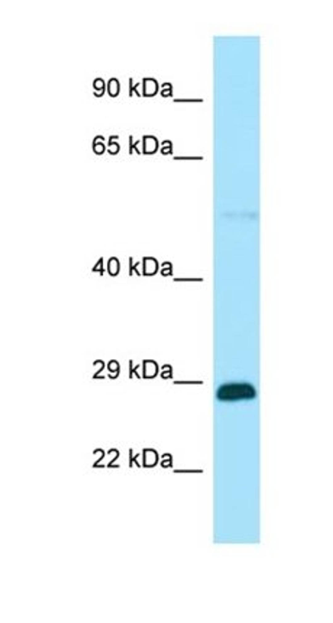 Western blot analysis of human HT1080 tissue using RABGAP1L antibody