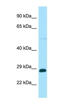 Western blot analysis of human HT1080 tissue using RABGAP1L antibody