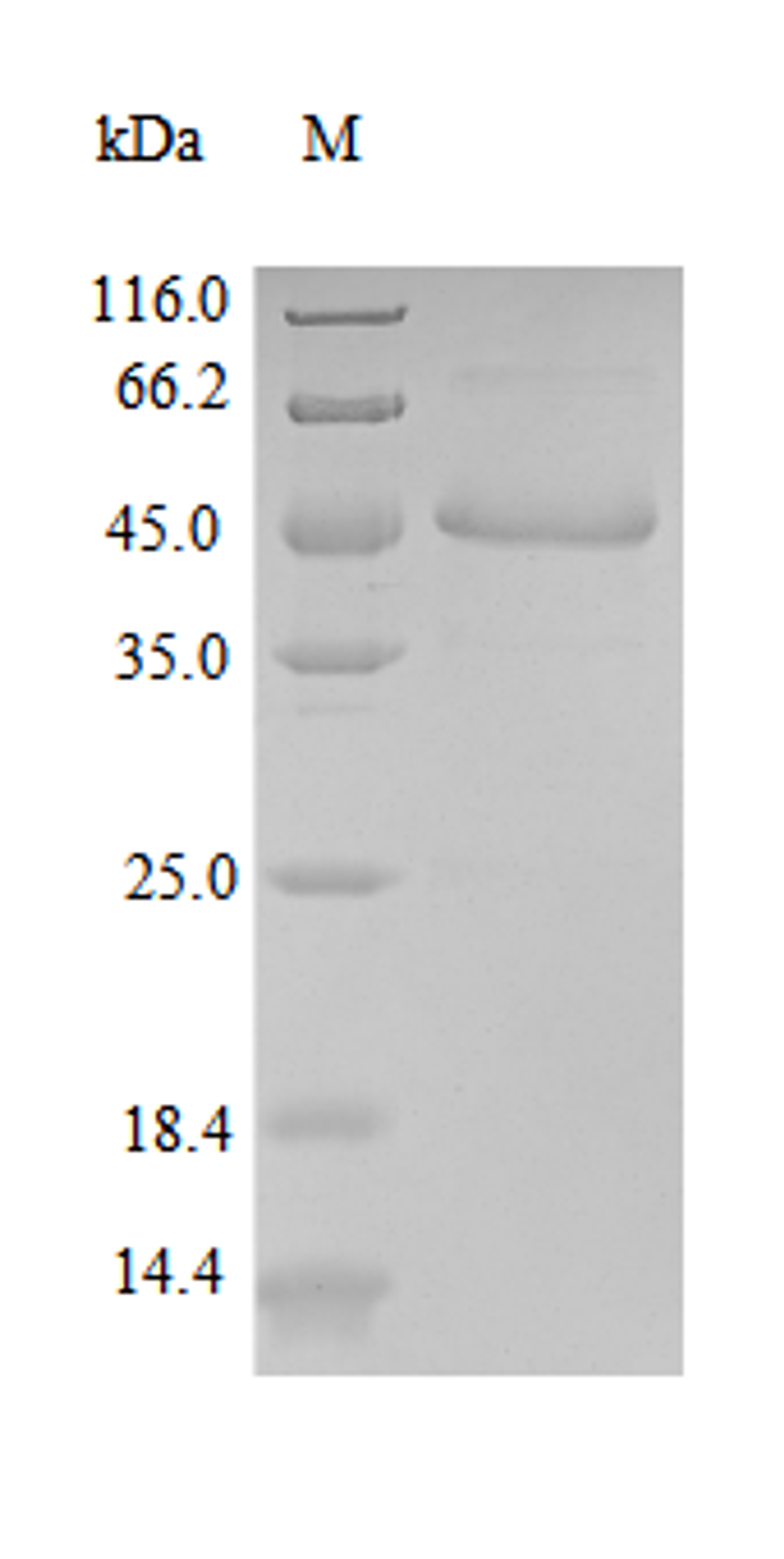 (Tris-Glycine gel) Discontinuous SDS-PAGE (reduced) with 5% enrichment gel and 15% separation gel.