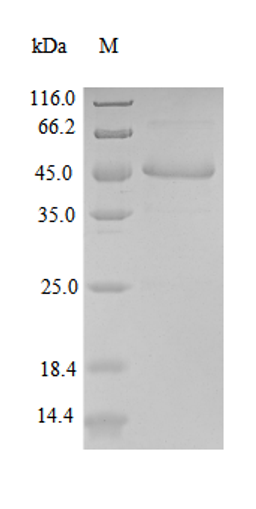 (Tris-Glycine gel) Discontinuous SDS-PAGE (reduced) with 5% enrichment gel and 15% separation gel.