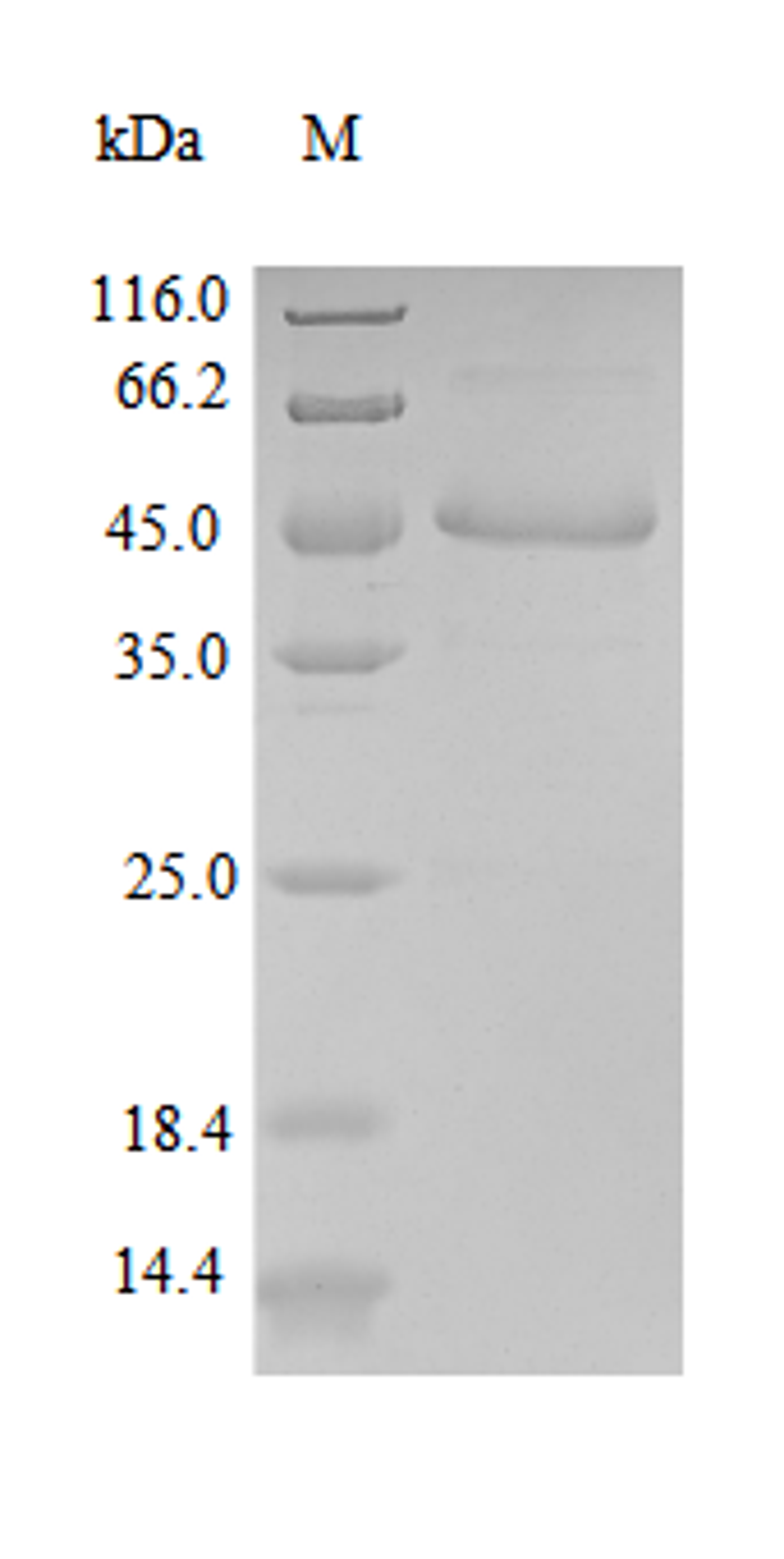 (Tris-Glycine gel) Discontinuous SDS-PAGE (reduced) with 5% enrichment gel and 15% separation gel.