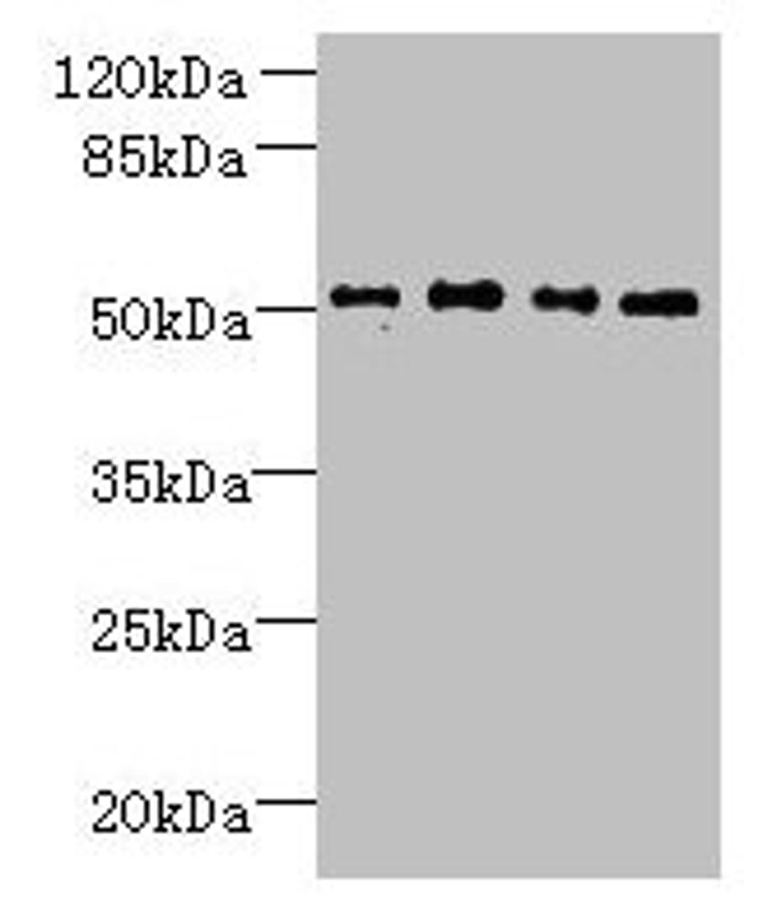 Western blot. All lanes: TTC38 antibody at 1.5µg/ml. Lane 1: U251 whole cell lysate. Lane 2: Mouse liver tissue. Lane 3: HepG2 whole cell lysate. Lane 4: K562 whole cell lysate. Secondary. Goat polyclonal to rabbit IgG at 1/10000 dilution. Predicted band size: 53 kDa. Observed band size: 53 kDa