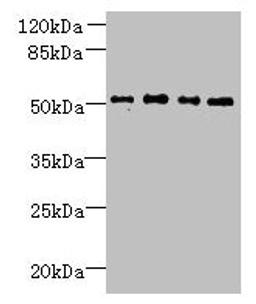 Western blot. All lanes: TTC38 antibody at 1.5µg/ml. Lane 1: U251 whole cell lysate. Lane 2: Mouse liver tissue. Lane 3: HepG2 whole cell lysate. Lane 4: K562 whole cell lysate. Secondary. Goat polyclonal to rabbit IgG at 1/10000 dilution. Predicted band size: 53 kDa. Observed band size: 53 kDa