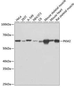 Western blot - PKM2 antibody (A19102)