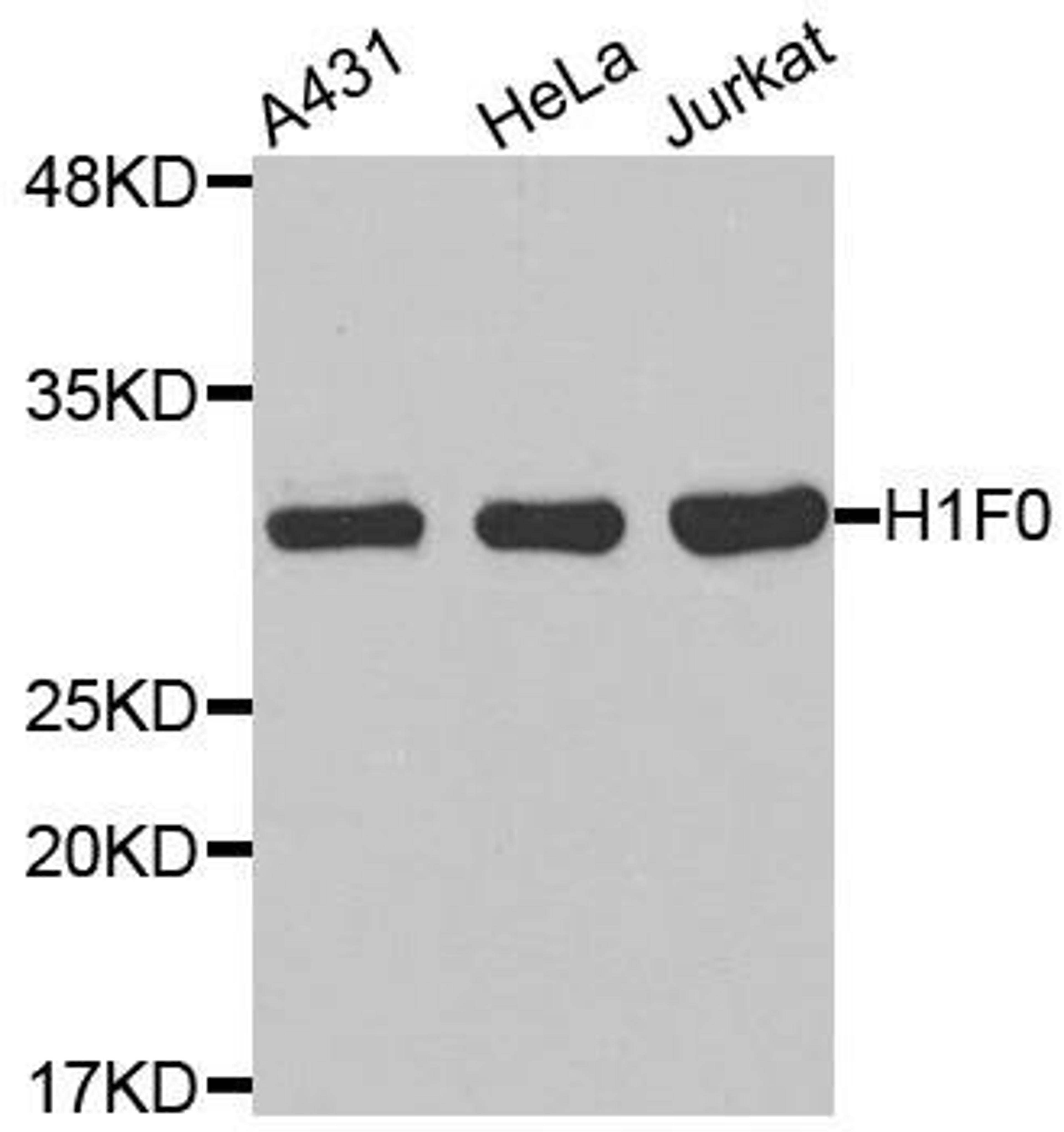 Western blot analysis of extracts of various cell lines using H1F0 antibody