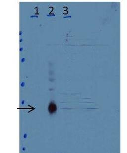 Western blot analysis of Lane 1: untreated wild-type (WT) cells Lane 2: WT cells treated 3 h with LPS Lane 3: C/EBPd-knock-out cells treated 3H with LPS Load: 35 ug per lane using CEBP Delta antibody